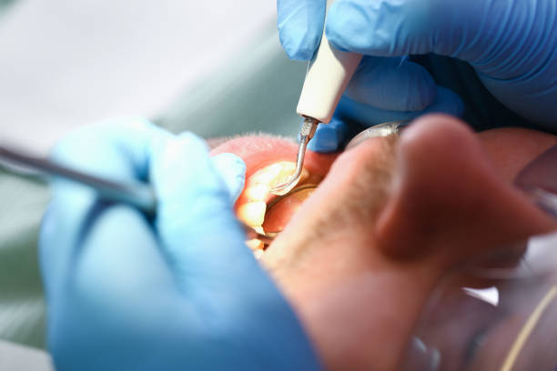 Best Emergency Orthodontic Services in Pineville, LA